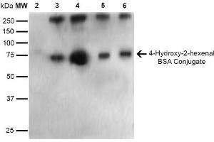 Western Blot analysis of 4-hydroxy-2-hexanal-BSA Conjugate showing detection of 67 kDa 4-hydroxy-2-hexenal-BSA using Mouse Anti-4-hydroxy-2-hexenal Monoclonal Antibody, Clone 6F10 . (4-Hydroxy-2-Hexenal (4-HHE) Antikörper (Atto 390))
