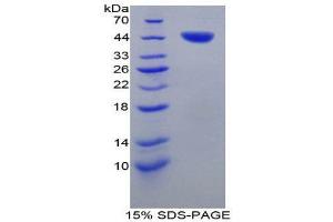SDS-PAGE (SDS) image for Tryptase alpha/beta 1 (TPSAB1) (AA 151-275) protein (His tag,GST tag) (ABIN2123719)