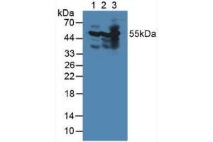 Western blot analysis of (1) Mouse Heart Tissue, (2) Mouse Brain Tissue and (3) Mouse Kidney Tissue. (PDHX Antikörper  (AA 222-471))
