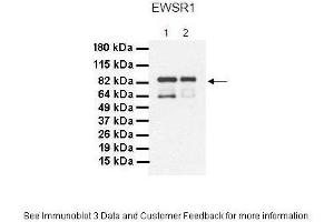 Lanes:   1. (EWSR1 Antikörper  (Middle Region))