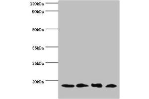 Western blot All lanes: UBE2V2 antibody at 3 μg/mL Lane 1: Hela whole cell lysate Lane 2: Mouse brain tissue Lane 3: Jurkat whole cell lysate Lane 4: K562 whole cell lysate Secondary Goat polyclonal to rabbit IgG at 1/10000 dilution Predicted band size: 16 kDa Observed band size: 16 kDa (UBE2V2 Antikörper  (AA 1-145))