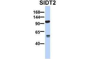 Host:  Rabbit  Target Name:  SERPINA3  Sample Type:  Human Adult Placenta  Antibody Dilution:  1. (SIDT2 Antikörper  (N-Term))