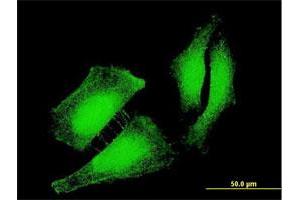 Immunofluorescence of monoclonal antibody to FOXO3 on HeLa cell. (FOXO3 Antikörper  (AA 361-460))