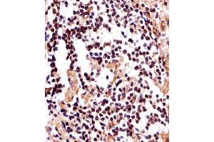 Immunohistochemical analysis of paraffin-embedded H. (IZUMO2 Antikörper  (AA 90-124))