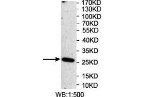 Western blot analysis of recombinant protein using OSGIN2 Antibody. (OSGIN2 Antikörper)