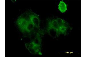 Immunofluorescence of monoclonal antibody to GCA on MCF-7 cell. (Grancalcin Antikörper  (AA 1-217))