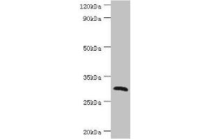 Western blot All lanes: C-type lectin domain family 12 member A antibody at 2 μg/mL + Mouse skeletal muscle tissue Secondary Goat polyclonal to rabbit IgG at 1/10000 dilution Predicted band size: 31, 33, 9, 28, 25 kDa Observed band size: 31 kDa