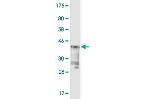 Western Blot detection against Immunogen (37. (USP5 Antikörper  (AA 71-180))