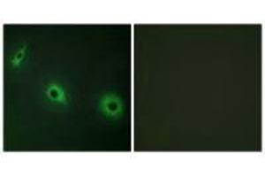 Immunofluorescence analysis of HepG2 cells, using CELSR3 antibody. (CELSR3 Antikörper)