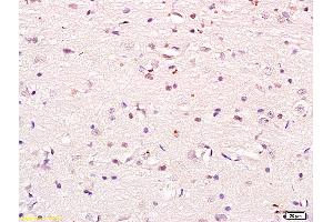 Formalin-fixed and paraffin embedded mouse heart labeled with Anti phospho-PI3K p85/PIK3R1(Tyr368) Polyclonal Antibody, Unconjugated (ABIN711041) at 1:200 followed by conjugation to the secondary antibody and DAB staining (PIK3R1 Antikörper  (pTyr368))