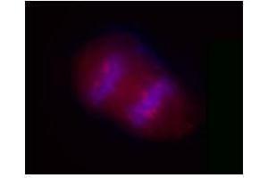 Immunofluorescence (IF) image for anti-Salt-Inducible Kinase 2 (SIK2) antibody (ABIN2666364) (SIK2 Antikörper)