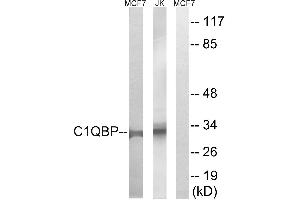 Immunohistochemistry analysis of paraffin-embedded human tonsil tissue, using C1QBP antibody. (C1QBP Antikörper)