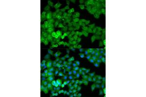 Immunofluorescence analysis of HeLa cell using JUP antibody. (JUP Antikörper  (AA 1-300))
