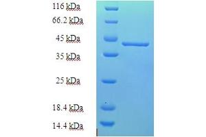 SDS-PAGE (SDS) image for Coiled-Coil-Helix-Coiled-Coil-Helix Domain Containing 4 (CHCHD4) (AA 1-142), (full length) protein (His-SUMO Tag) (ABIN5711676) (CHCHD4 Protein (AA 1-142, full length) (His-SUMO Tag))