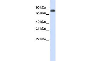 WB Suggested Anti-MST1 Antibody Titration:  0. (MST1 Antikörper  (Middle Region))