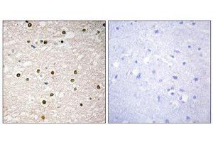 Immunohistochemistry (IHC) image for anti-Tumor Protein P73 (TP73) (Internal Region) antibody (ABIN1848961) (Tumor Protein p73 Antikörper  (Internal Region))