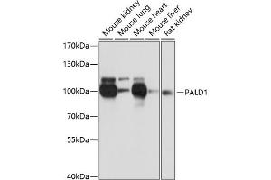 Western blot analysis of extracts of various cell lines, using P antibody (ABIN6133270, ABIN6145194, ABIN6145195 and ABIN6216692) at 1:3000 dilution. (KIAA1274 Antikörper  (AA 1-300))