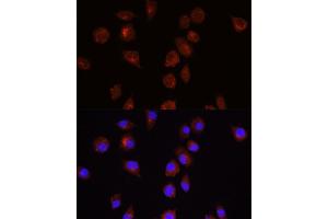 Immunofluorescence analysis of L929 cells using  antibody (ABIN6127334, ABIN6136734, ABIN6136739 and ABIN6221182) at dilution of 1:100. (AKT1 Antikörper  (AA 1-150))