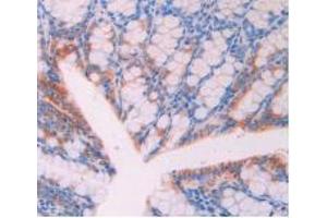 Figure. (CD47 Antikörper  (AA 18-219))