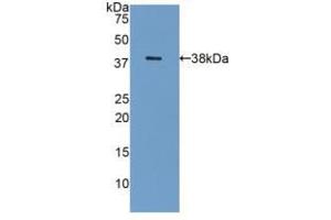 Western blot analysis of recombinant Human GAL8. (LGALS8 Antikörper  (AA 1-317))