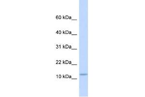 WB Suggested Anti-C9orf46 Antibody Titration:  0. (PLGRKT Antikörper  (Middle Region))