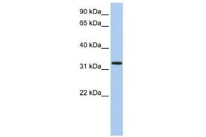 C12ORF24 antibody used at 1 ug/ml to detect target protein. (C12ORF24 Antikörper  (N-Term))