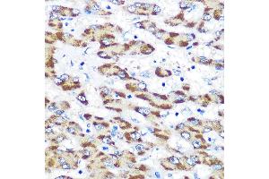 Immunohistochemistry of paraffin-embedded human liver using Presenilin 1 Rabbit pAb (ABIN3023159, ABIN3023160, ABIN3023161 and ABIN6219418) at dilution of 1:100 (40x lens).
