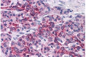 Human Pancreas: Formalin-Fixed, Paraffin-Embedded (FFPE) (XIAP Antikörper  (AA 75-226))