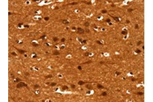 The image on the left is immunohistochemistry of paraffin-embedded Human brain tissue using ABIN7190038(CACNA1E Antibody) at dilution 1/15, on the right is treated with synthetic peptide. (CACNA1E Antikörper)