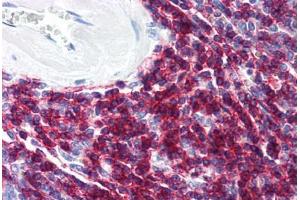 Human Spleen (formalin-fixed, paraffin-embedded) stained with CD6 antibody ABIN294221 at 10 ug/ml followed by biotinylated anti-mouse IgG secondary antibody ABIN481714, alkaline phosphatase-streptavidin and chromogen. (CD6 Antikörper)