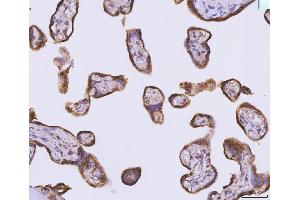 IHC analysis of ATP5F1B using anti-ATP5F1B antibody (ABIN7599866). (Atp5f1b (AA 123-529) Antikörper)