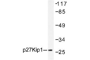 Image no. 1 for anti-Cyclin-Dependent Kinase Inhibitor 1B (p27, Kip1) (CDKN1B) antibody (ABIN271763) (CDKN1B Antikörper)