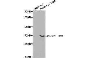 Western blot analysis of extracts from Hela cells, using Phospho-LIMK1-T508 antibody. (LIM Domain Kinase 1 Antikörper  (pThr508))