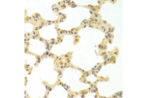 Immunohistochemistry of paraffin-embedded rat lung using IRF3 antibody (ABIN4904080) at dilution of 1:100 (40x lens). (IRF3 Antikörper)