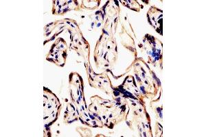 (ABIN6242136 and ABIN6578441) staining ERVK-7 in human placenta tissue sections by Immunohistochemistry (IHC-P - paraformaldehyde-fixed, paraffin-embedded sections). (ERVK-7 Antikörper  (AA 96-128))