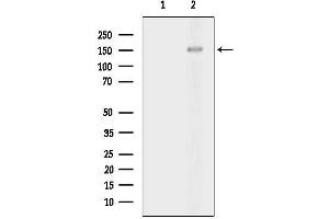 Western blot analysis of lysates from 3-L1 cells(heat-shock treatment), using Phospho-PTP alpha (Tyr798) Antibody.