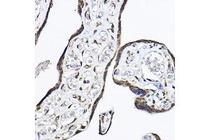 Immunohistochemistry of paraffin-embedded human placenta using P Rabbit pAb (ABIN6130631, ABIN6145213, ABIN6145214 and ABIN6214119) at dilution of 1:50 (40x lens). (PAP Associated Domain Containing 7 (PAPD7) (AA 303-542) Antikörper)