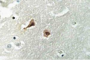 Immunohistochemistry (IHC) analyzes of VCP antibody in paraffin-embedded human brain tissue. (VCP Antikörper)
