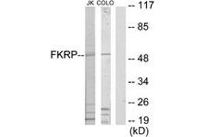 Western blot analysis of extracts from Jurkat/COLO205 cells, using FKRP Antibody. (FKRP Antikörper  (AA 1-50))