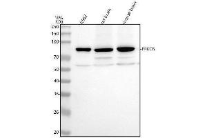 Western blot analysis of PRKCB using anti-PRKCB antibody (ABIN7605965).