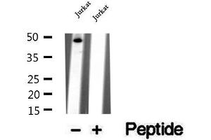 Western blot analysis of extracts of Jurkat cells, using WDR18 antibody.
