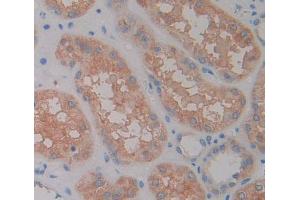 Used in DAB staining on fromalin fixed paraffin- embedded kidney tissue (RGS7 Antikörper  (AA 1-144))