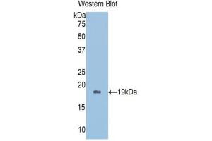Western blot analysis of the recombinant protein. (Peroxiredoxin 5 Antikörper  (AA 1-162))
