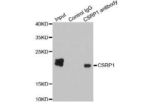 Immunoprecipitation analysis of 200ug extracts of HepG2 cells using 1ug CSRP1 antibody.