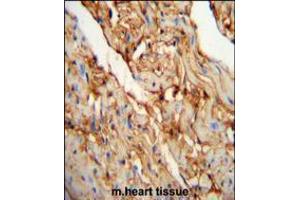 MYOZ1 Antibody immunohistochemistry analysis in formalin fixed and paraffin embedded mouse heart tissue followed by peroxidase conjugation of the secondary antibody and DAB staining. (Myozenin 1 Antikörper  (AA 40-69))