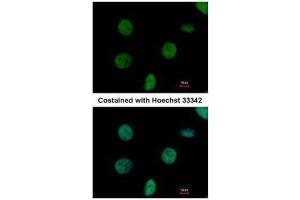 ICC/IF Image Immunofluorescence analysis of paraformaldehyde-fixed HeLa, using C1orf57, antibody at 1:500 dilution. (C1orf57 Antikörper  (C-Term))