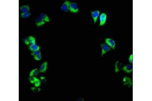 Immunofluorescence staining of PC-3 cells with ABIN7158533 at 1:166, counter-stained with DAPI. (FCER2 Antikörper  (AA 48-321))