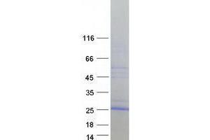 Western Blotting (WB) image for Vitelline Membrane Outer Layer 1 Homolog (VMO1) (Transcript Variant 1) protein (Myc-DYKDDDDK Tag) (ABIN2735383)