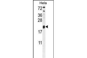 TRPC3 Antibody (N-term) 10175a western blot analysis in Hela cell line lysates (35 μg/lane). (TRAPPC3 Antikörper  (N-Term))