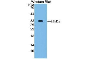 Detection of Recombinant SHP, Human using Polyclonal Antibody to Nuclear Receptor Subfamily 0,Group B,Member 2 (NR0B2) (NR0B2 Antikörper  (AA 1-257))